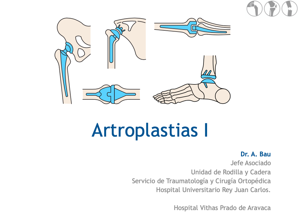 Seminario Artroplastias II