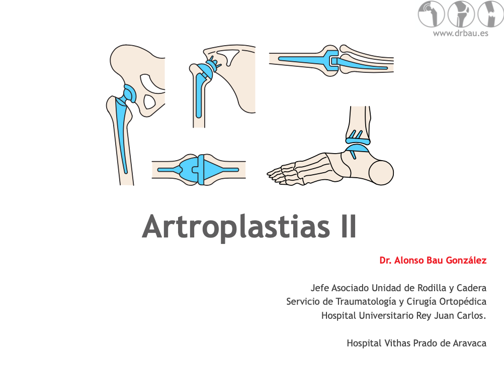 Seminario Artroplastias II